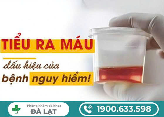 Hình ảnh minh họa